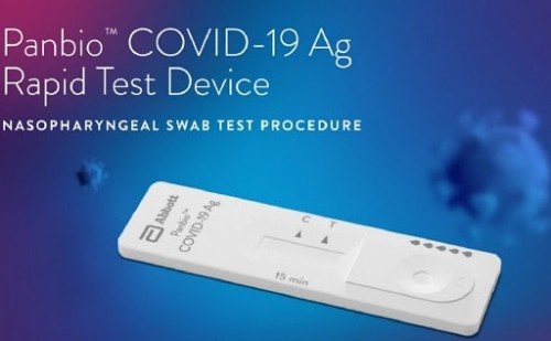 Este kit indica en 15 minutos si te contagiaste de Covid 19