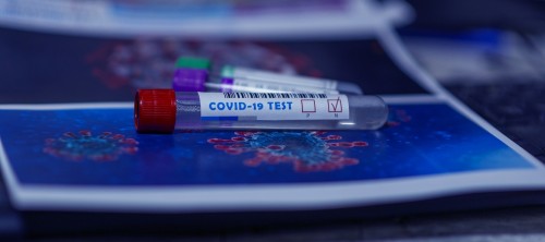 Covid 19: qué hace cada prueba y qué resultados nos da