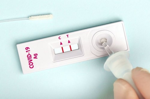 Lo que hay que saber sobre el test de antígeno rápido para el autodiagnóstico